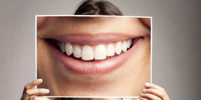 Full mouth dental restoration in Greece
